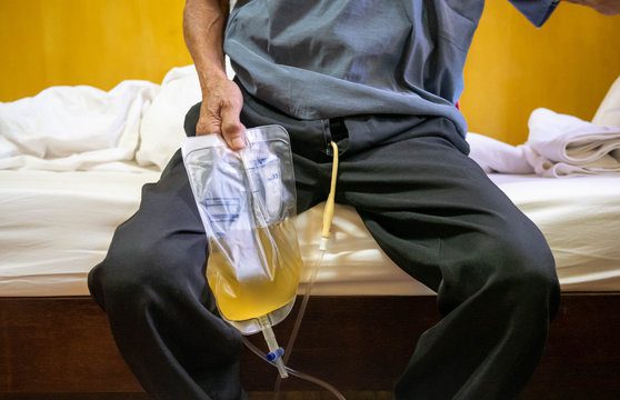 prostate-enlargement-natural-solution